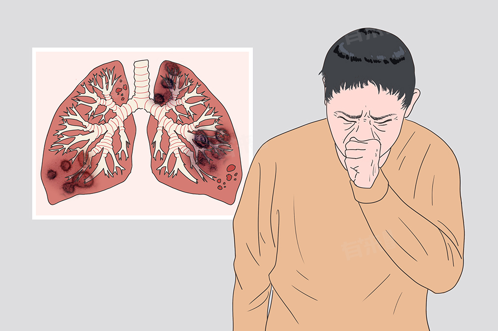 新型冠狀病毒的傳播途徑及預(yù)防措施，關(guān)乎疫情傳播關(guān)鍵要點(diǎn)